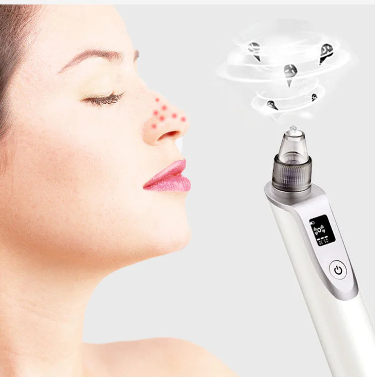 Pore Cleanser Ultrasonic Blackhead Remover
