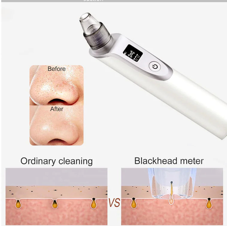 Pore Cleanser Ultrasonic Blackhead Remover